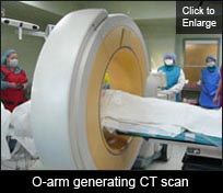 O-arm generating CT scan